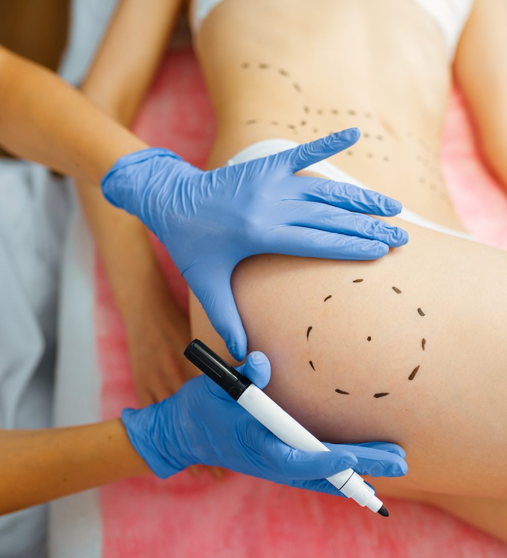 Cosmetician with marker puts dotted lines on female patient body, botox injections preparation. Rejuvenation procedure in beautician salon. Cosmetic surgery against wrinkles and aging